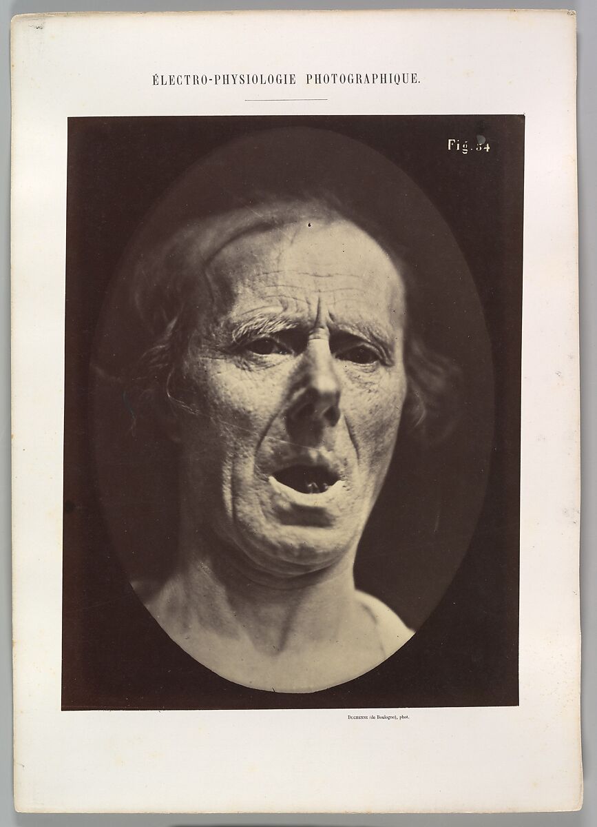 Figure 54: Voluntary lowering of the lower jaw, Guillaume-Benjamin-Amand Duchenne de Boulogne (French, 1806–1875), Albumen silver print from glass negative 