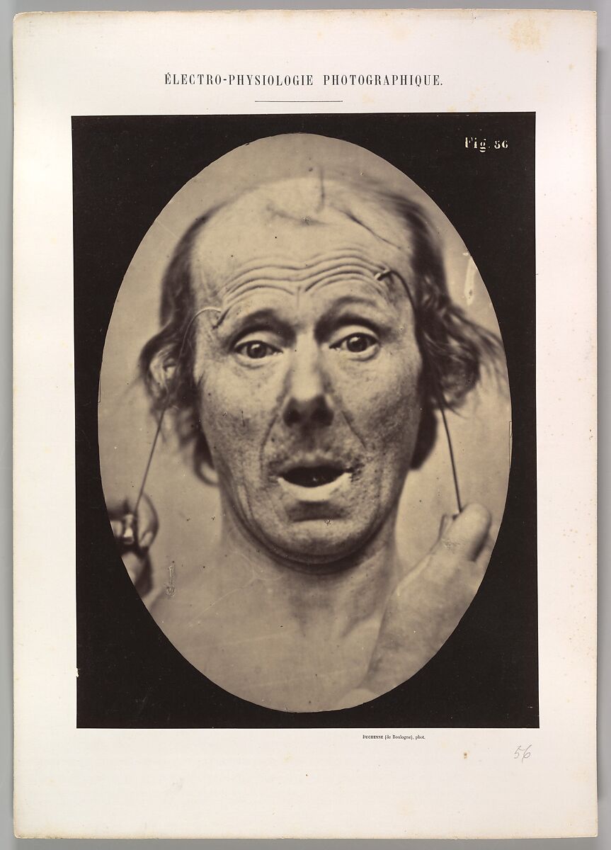 Figure 56: Surprise, Guillaume-Benjamin-Amand Duchenne de Boulogne (French, 1806–1875), Albumen silver print from glass negative 