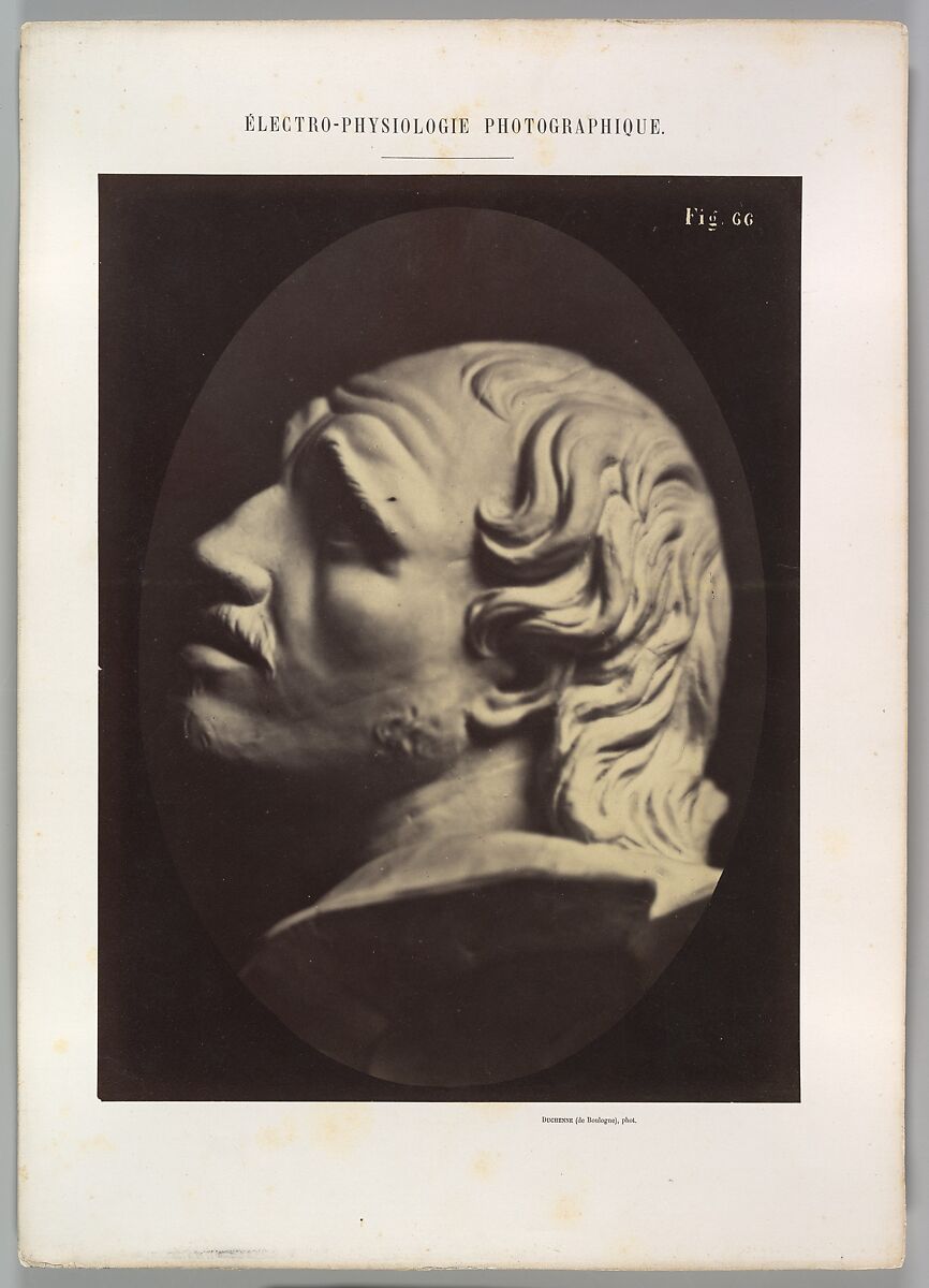 Figure 66: Head of Arrotino (the spy, the knife grinder, and so on), Guillaume-Benjamin-Amand Duchenne de Boulogne (French, 1806–1875), Albumen silver print from glass negative 