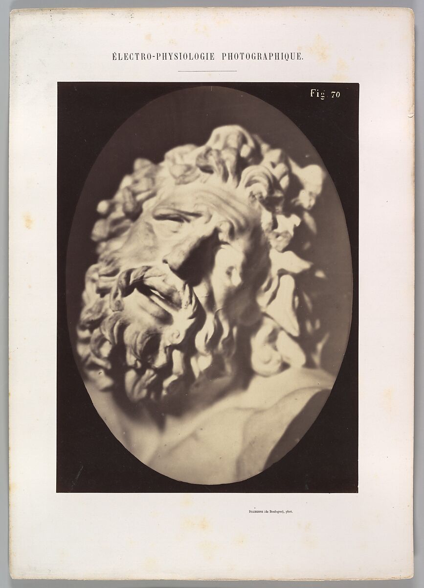 Figure 70: Head of the Laocoön of Rome, Guillaume-Benjamin-Amand Duchenne de Boulogne (French, 1806–1875), Albumen silver print from glass negative 