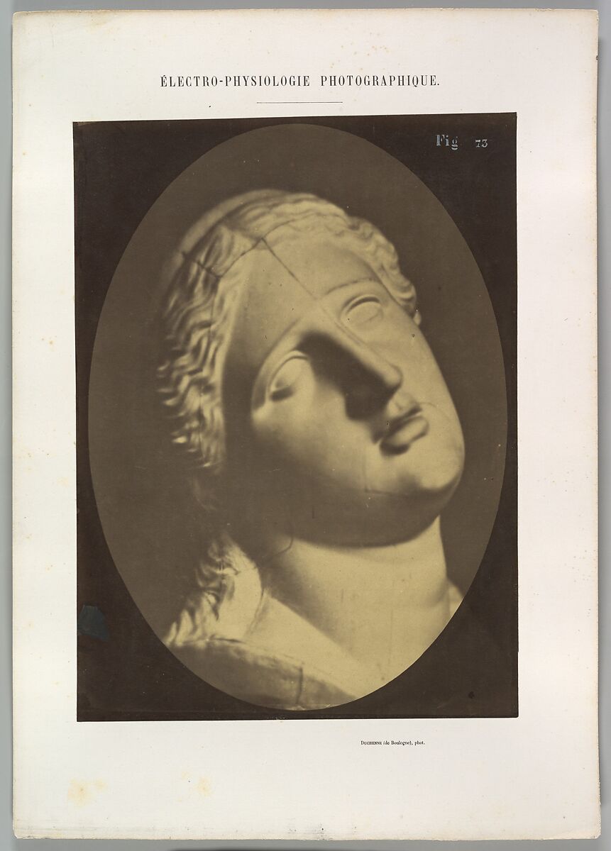 Figure 73: Head of Niobe, Guillaume-Benjamin-Amand Duchenne de Boulogne (French, 1806–1875), Albumen silver print from glass negative 