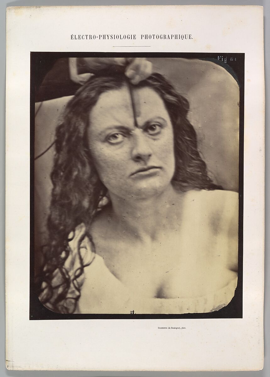 Figure 81: Lady Macbeth, moderate expression of cruelty, Guillaume-Benjamin-Amand Duchenne de Boulogne (French, 1806–1875), Albumen silver print from glass negative 