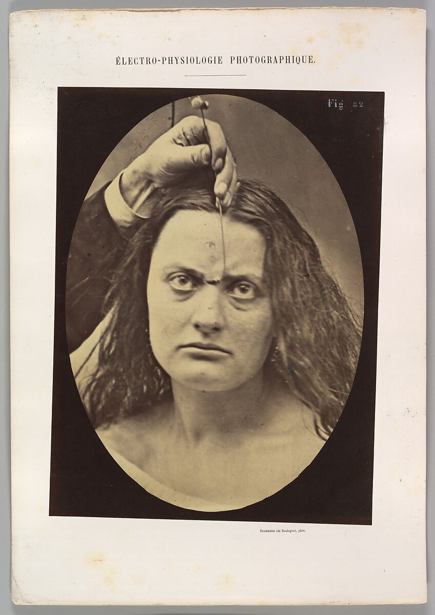 Figure 82: Lady Macbeth, strong expression of cruelty, Guillaume-Benjamin-Amand Duchenne de Boulogne (French, 1806–1875), Albumen silver print from glass negative 