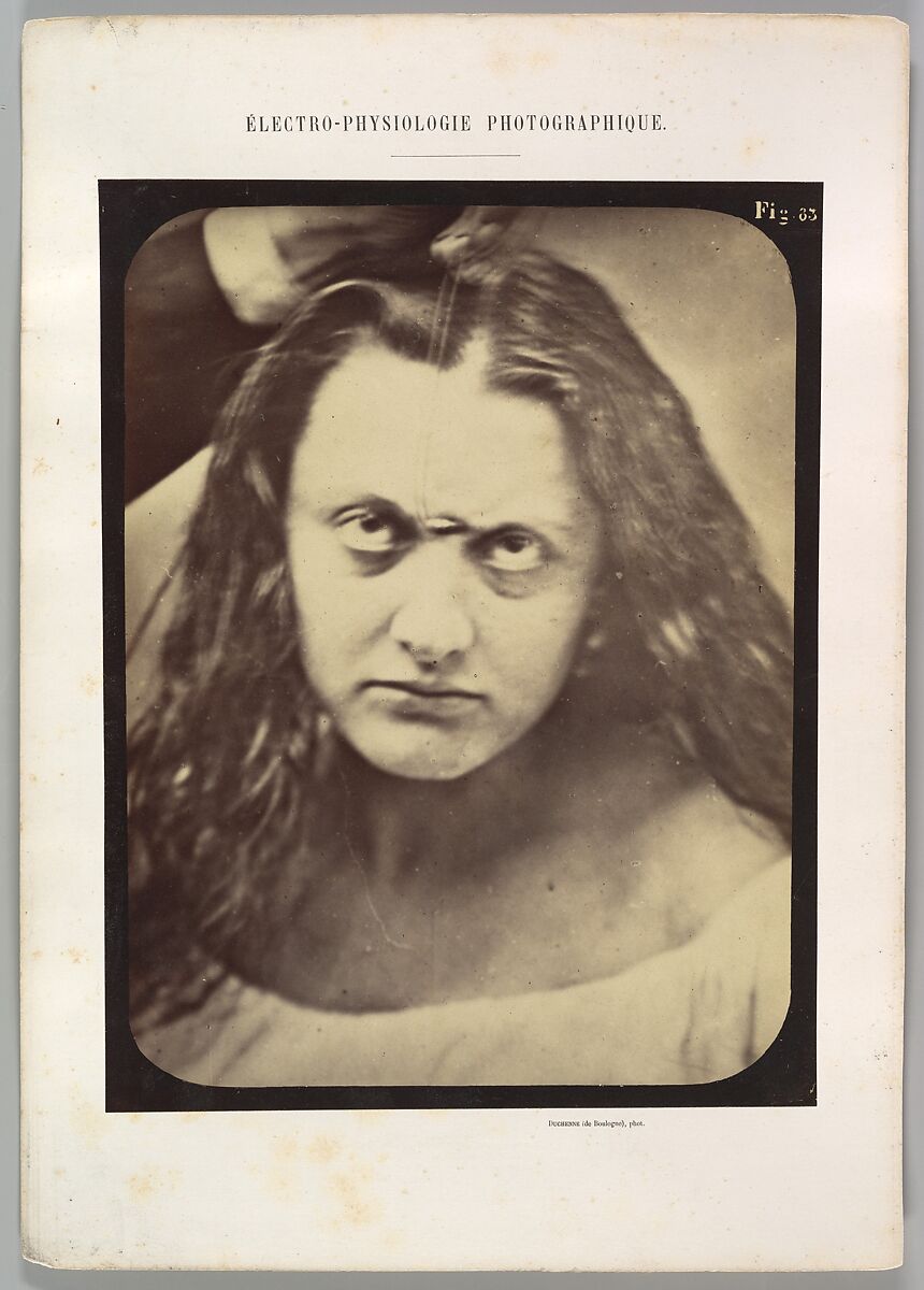Figure 83: Lady Macbeth, ferocious cruelty, Guillaume-Benjamin-Amand Duchenne de Boulogne (French, 1806–1875), Albumen silver print from glass negative 