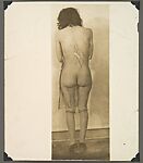 [Crime Scene Album], Compiled by Dr. Edward E. Smith (American), Gelatin silver prints