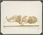 [Crime Scene Album], Compiled by Dr. Edward E. Smith (American), Gelatin silver prints