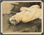 [Crime Scene Album], Compiled by Dr. Edward E. Smith (American), Gelatin silver prints
