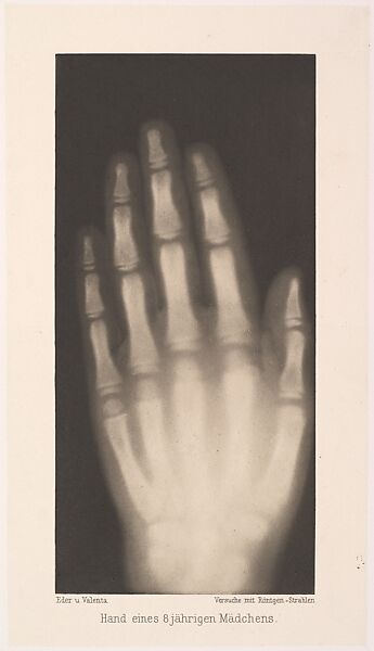 Hand eines 8 jährigen Mädchens, Josef Maria Eder (Austrian, Krems an der Donau, 1855–1944 Kitzbühel) and, Photogravure 