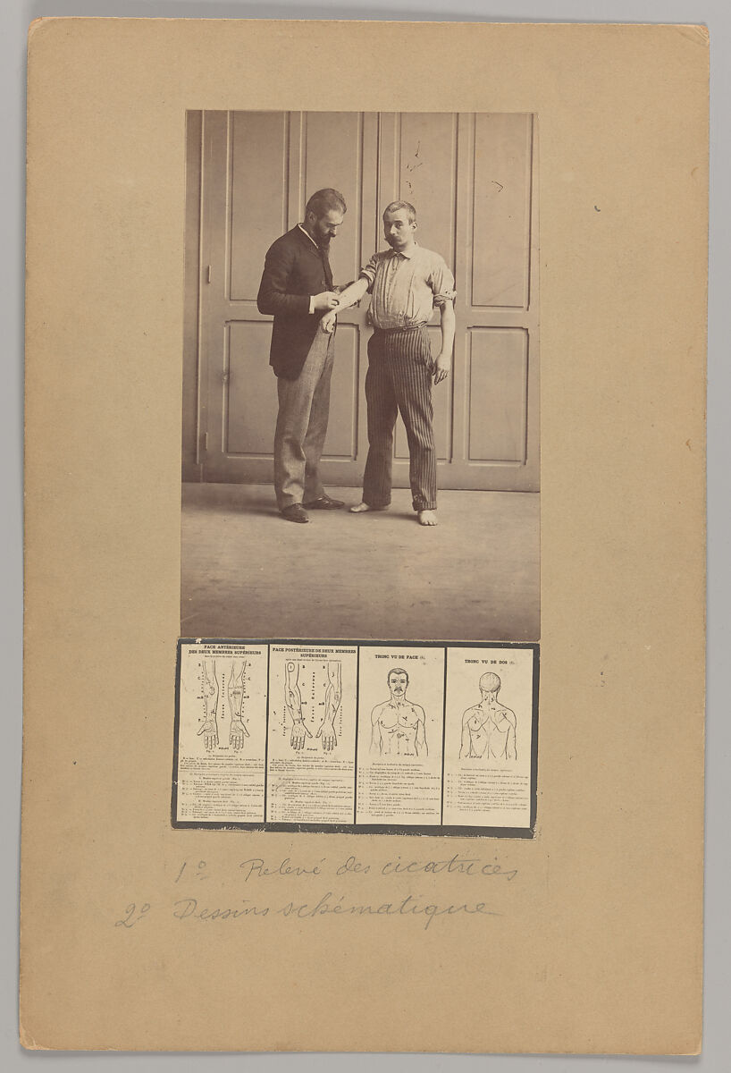 Notation of Scars, Schematic Drawings, Alphonse Bertillon (French, 1853–1914), Albumen silver prints 