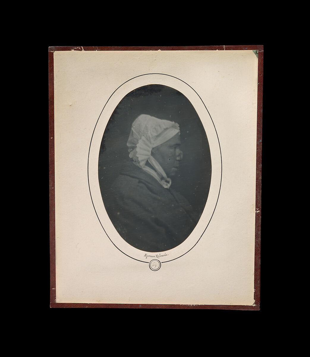 [Profile of a Woman with Necrosis of the Nose], Louis-Auguste Bisson (French, 1814–1876), Daguerreotype 