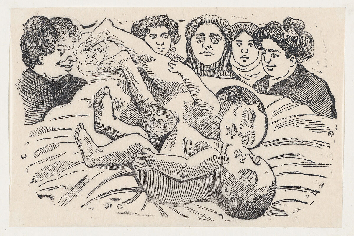 Siamese Twins, José Guadalupe Posada (Mexican, Aguascalientes 1852–1913 Mexico City), Zincograph 