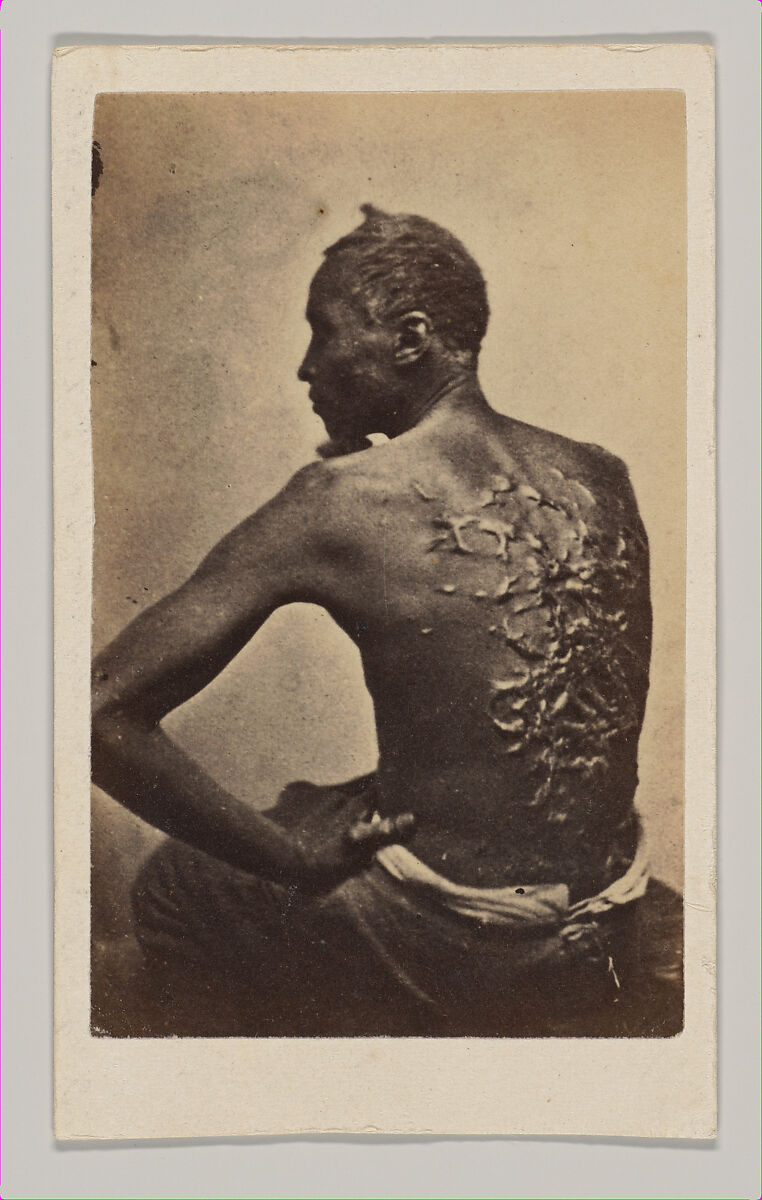 Gordon or "The Scourged Back", McPherson &amp; Oliver (American, active New Orleans and Baton Rouge, Louisiana, 1860s), Albumen silver print from glass negative 