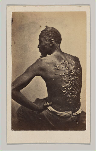 Gordon, A Runaway Mississippi Slave,  or 