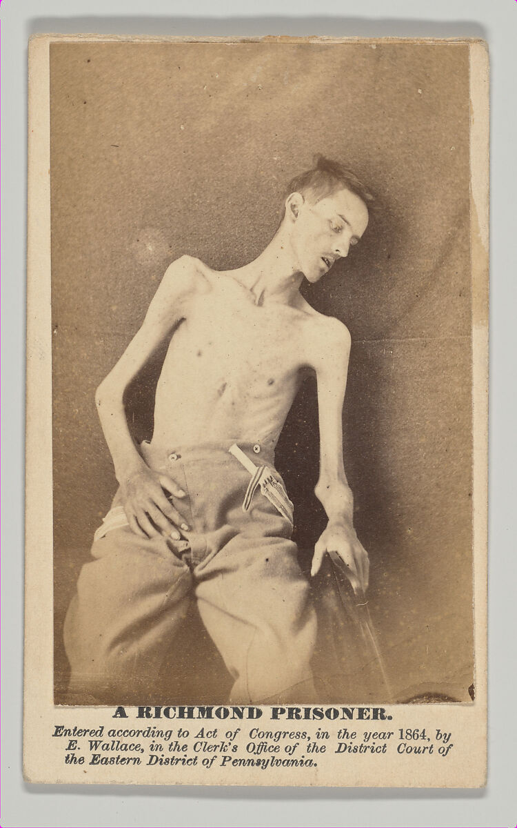 A Richmond Prisoner, Ellerslie Wallace, Jr., M.D. (American, 1819–1885), Albumen silver print from glass negative 