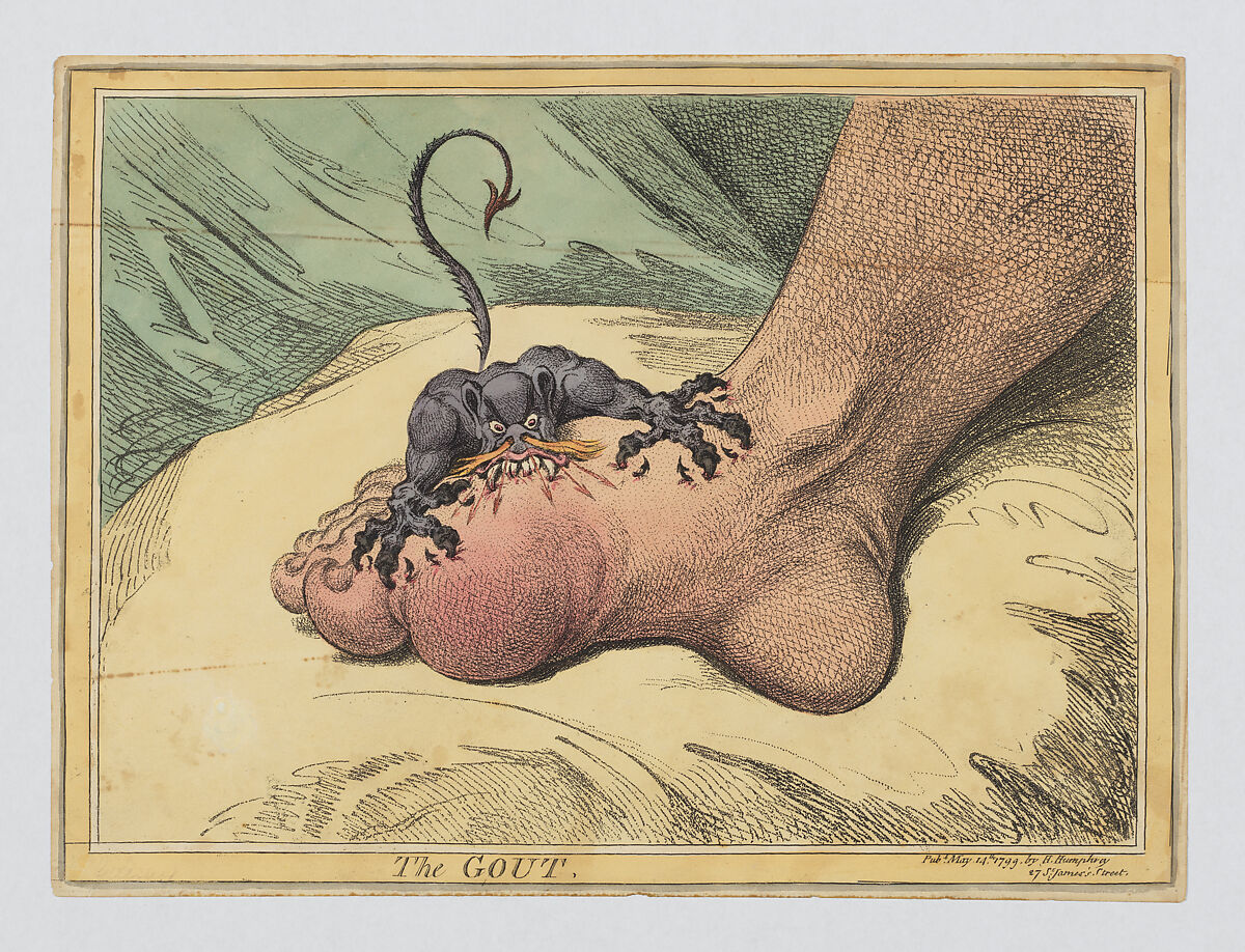The Gout, James Gillray (British, London 1756–1815 London), Hand-colored soft-ground etching 
