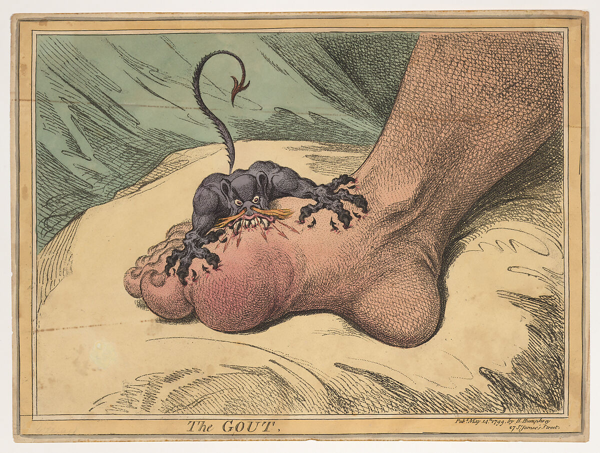 The Gout, James Gillray (British, London 1756–1815 London), Hand-colored soft-ground etching