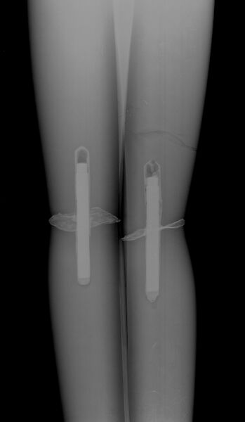 Marble female figure, Marble, Cycladic